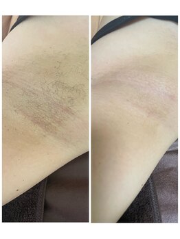 エン(en.)/Before After写真１