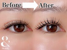 プリュム(plume)/アンドヘルシー(最新技術)