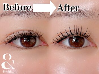 プリュム(plume)/アンドヘルシー(最新技術)