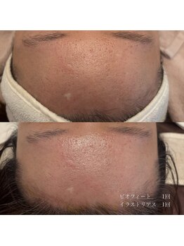 エクラ(eclat)/クリスティーナ