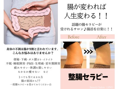 リノ(LINO)の写真