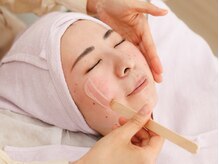 アイ(Aye)の雰囲気（お肌に優しいワックスで全顔ツルピカ♪まつ毛眉毛とセットがお得）