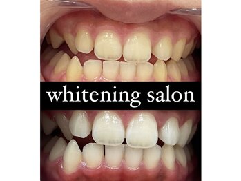 チェルト 鈴鹿店(CERTO)/歯のホワイトニング