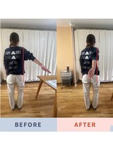 アイヲン(Aiwon)/【肩こり】【腕が上がらない】