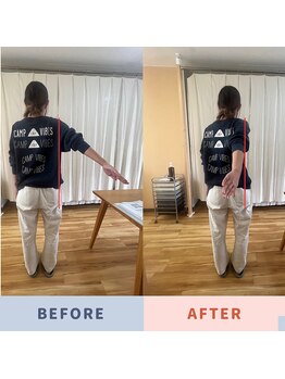 アイヲン(Aiwon)/【肩こり】【腕が上がらない】