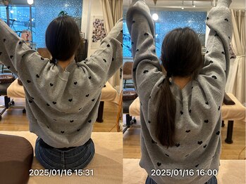 グレフル鍼灸接骨院 整体院 心斎橋/肩甲骨はがし／肩こり／首コリ