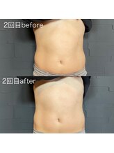 ビトタン 倉敷本店(+美to鍛)/【ダイエット】レモンボトル