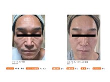 サロン メイリー(salon meili)/フォトコンテスト受賞写真