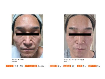 サロン メイリー(salon meili)/フォトコンテスト受賞写真