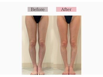 フロリール アザブジュウバン(FlorirAzabujuban)/痩身/美脚/ブライダル