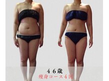全身集中ダイエットコース４回目でポッコリお腹解消