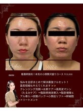 リノン(LIINON)/面長さんも短縮叶う！フルコース