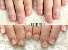 グラシナ 鳥丸店/(深爪/長さだし/フィルイン/)