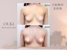 【育乳・バスト専門×女性らしさを磨く】OUKI. 梅田北新地【3月1日 OPEN（予定）】/バスト結果写真