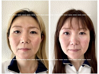 シラカワ 小倉院(SHIRAKAWA)の写真