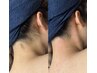 【全身脱毛/女性】全身脱毛(顔VIOなし)+うなじWAX