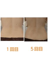 グランクール/インキュア