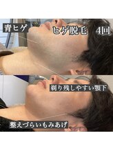 プリマプリート 大垣店/メンズひげ脱毛