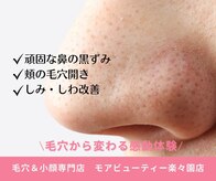 モアビューティー 楽々園店(MORE BEAUTY)