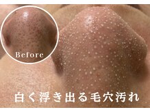 エス(ES esthetique salon)の雰囲気（TikTok大バズり3000万再生☆毛穴が白く浮き出る韓国式3D毛穴洗浄）