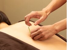 ジネコラボ 横浜東戸塚(Gyneco-labo)/妊活鍼灸/体質ケア