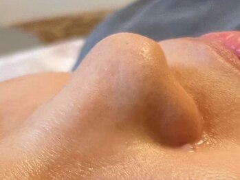 アプロディタの写真/【何度でもこの価格！鼻ハイドロ2,200円】冷えと乾燥で毛穴が目立ちやすくなる季節に集中ケア☆