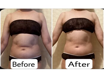 クリスタルビューティー/10回コース