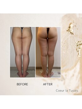 クーラ テュセ(Coeur la Tusais)/下半身集中痩身