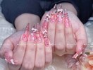 スカルプ無制限