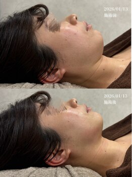 クレビア(CREBIA)/