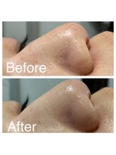 オリンピア 横浜(OLYMPIA)/