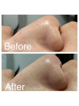 オリンピア 横浜(OLYMPIA)/