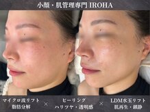 イロハ(IROHA)