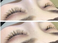 ビタミン(Vitamin*)/