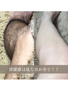 カラー(COLOR)/最新LED脱毛機導入!!