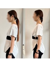 ホリック アイス コア ボディ(HOLIC ICE CORE BODY)/お客様ビフォーアフター6