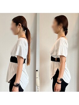 ホリック アイス コア ボディ(HOLIC ICE CORE BODY)/お客様ビフォーアフター6