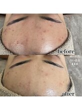 ベル(Belle)/【艶玉肌セルマン】