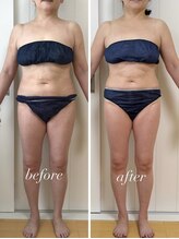 バニスティ 酒田店/3回の施術でこんなにスッキリ！