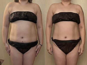 マイティー整骨院 ココア(CoCoa)/セルクラ