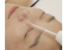 K.ステージの雰囲気（ハイフルクエンシー毛穴洗浄オゾンの力で汚れを浮き上がり美肌に）