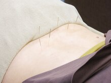 鍼で慢性腰痛も肩こりもご相談ください。〈肩こり/腰痛/妊活/〉
