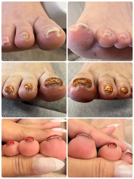 アイラスジュニア(AILAS.Jr)/