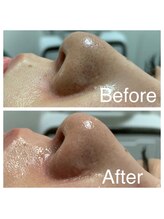 オリンピア 横浜(OLYMPIA)/