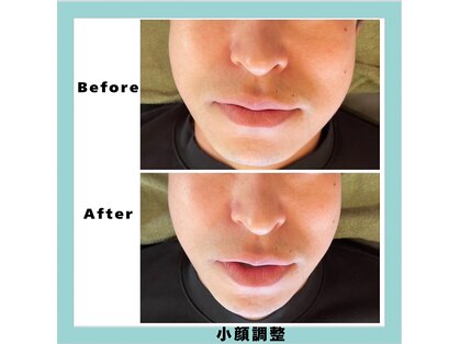 クローバー 周南本店(Clover)の写真