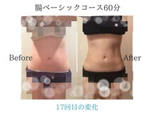 リープル(Leapl)/【痩身】腸もみ後の変化写真