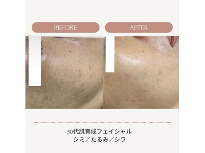 ジェルベーラ(Gerbera)の写真