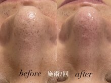 リスポアラボ(LIS PORE.LAB)/