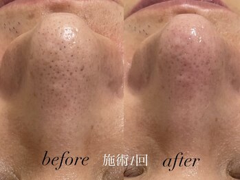 リスポアラボ(LIS PORE.LAB)/