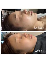 オリンピア 横浜(OLYMPIA)/